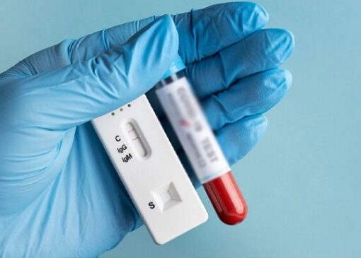 فناوری تولید کیت‌های تشخیص HIV توسعه می‌یابد