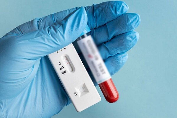 فناوری تولید کیت‌های تشخیص HIV توسعه می‌یابد