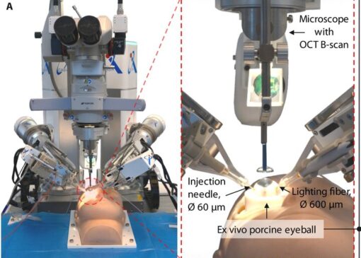 روبات و هوش مصنوعی جراح چشم شدند